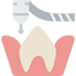 tooth Extraction